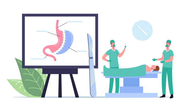 Medical Operable Weight Loss Procedure. Surgeon Male Characters Make Operation Bariatric Surgery Stomach Reduction Medical Operable Weight Loss Procedure. Surgeon Male Characters Make Operation Bariatric Surgery Stomach Reduction to Patient Lying on Medic Couch in Operating Room. Cartoon People Vector Illustration stomata stock illustrations