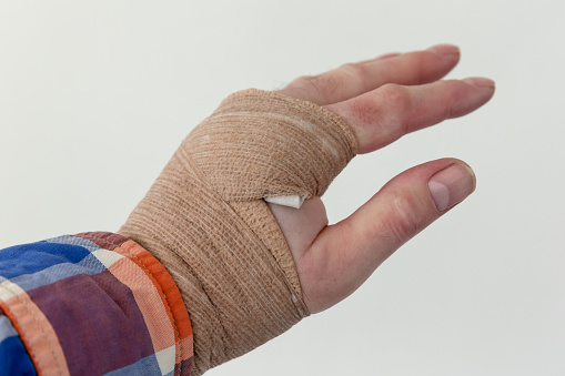 Close-up of the swollen hand of a caucasian male suffering from lymphedema while temporarily in bandage to reduce the volume in order take measure for wearing a compression glove