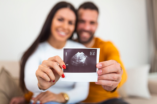 Woman and her boyfriend holding up an image of her sonogram of the baby. Young happy Couple with baby ultrasound photo
