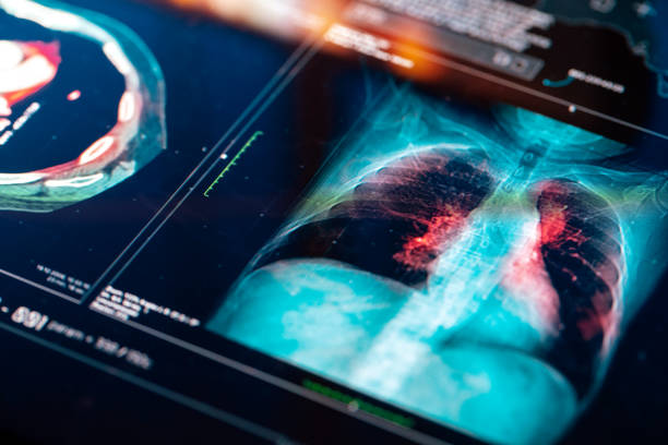 medical mri  scan - respiratory system imagens e fotografias de stock