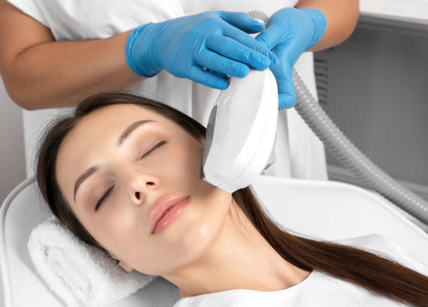 procedimiento de depilación de depilación elos en la cara de una mujer. beautician haciendo rejuvenecimiento láser en un salón de belleza. cuidado facial de la piel. cosmetología de ipl de hardware - beauty treatment fotos fotografías e imágenes de stock