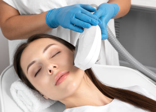 Elos epilation hair removal procedure on the face of a woman. Beautician doing laser rejuvenation in a beauty salon. Facial skin care. Hardware  ipl cosmetology Elos epilation hair removal procedure on the face of a woman. Beautician doing laser rejuvenation in a beauty salon. Facial skin care. Hardware  ipl cosmetology hair removal photos stock pictures, royalty-free photos & images