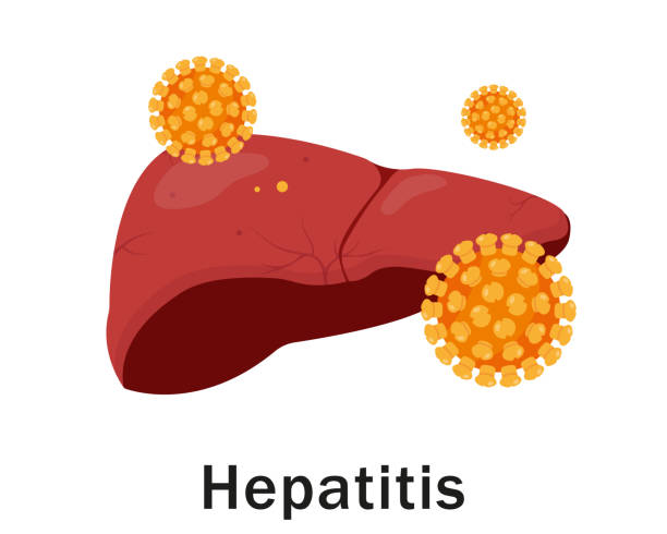 ilustraciones, imágenes clip art, dibujos animados e iconos de stock de hígado humano y virus de la hepetitis. - hepatitis virus