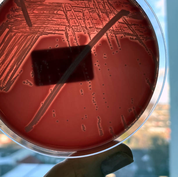 血中寒天板で増殖した血中細菌。 - blood agar ストックフォトと画像