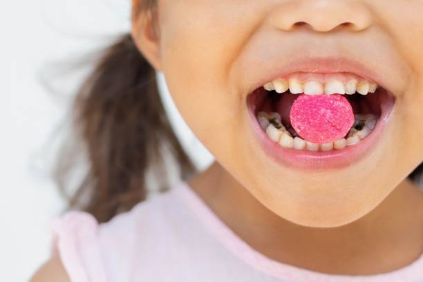 Little girl eating candy and sugar with bad oral hygiene and cavity. Teeth dental care. A little kid eating too much candy with teeth decay and yellow plack from bad oral care. dental cavity photos stock pictures, royalty-free photos & images