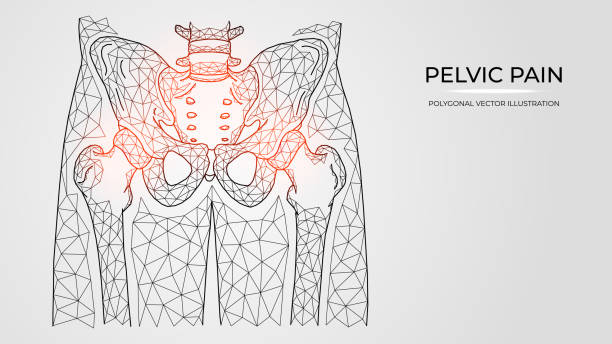 illustrations, cliparts, dessins animés et icônes de illustration polygonale de vecteur de douleur, inflammation ou blessure dans le bassin et l’articulation de hanche. modèles médicaux de maladies orthopédiques - ischion