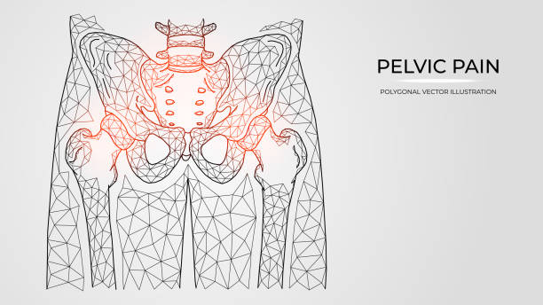 골반과 엉덩이 관절의 통증, 염증 또는 부상의 다각형 벡터 그림. 의료 정형 외과 질병 템플릿 - hip femur ilium pelvis stock illustrations