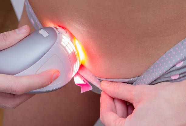 Woman with a IPL laser hair removal device shaving her bikini line. Removing unwanted pubic hair and using the pulsed light epilator at home. Woman with a IPL laser hair removal device shaving her bikini line. Removing unwanted pubic hair and using the pulsed light epilator at home. epilator stock pictures, royalty-free photos & images