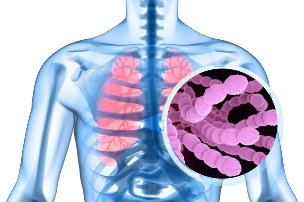 Photo of Streptococcus Pneumoniae Bacteria in Lungs