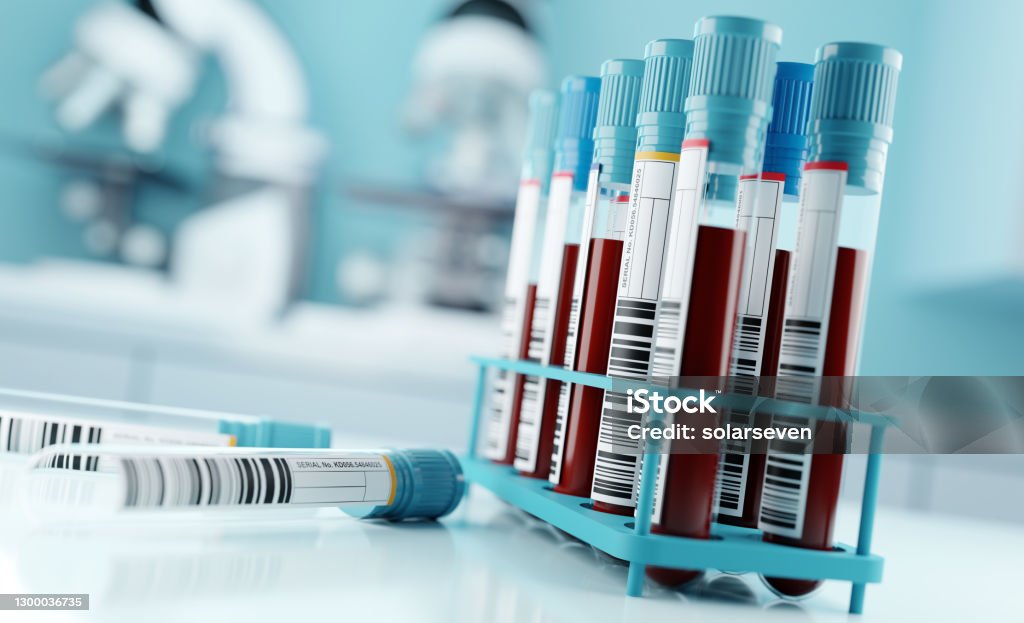 Blood Test Results In A Medical Lab Blood samples and test results in a clinical medical laboratory. 3D illustration Blood Test Stock Photo