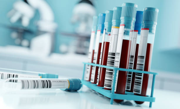 Blood Test Results In A Medical Lab Blood samples and test results in a clinical medical laboratory. 3D illustration blood stock pictures, royalty-free photos & images