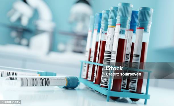 Blood Test Results In A Medical Lab Stock Photo - Download Image Now - Blood Test, Blood, Medical Exam