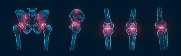 골반, 엉덩이 관절 및 무릎 관절에 있는 뼈의 고통 또는 염증의 다각형 벡터 삽화는 격리합니다. 관절 통증 개념 - ischium stock illustrations