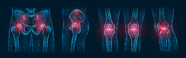 polygonale vektordarstellung von schmerzen oder entzündungen der knochen im becken, hüftgelenk und kniegelenke isoliert auf einem dunkelblauen hintergrund. orthopädische erkrankungen medizinische vorlage. - ischium stock-grafiken, -clipart, -cartoons und -symbole