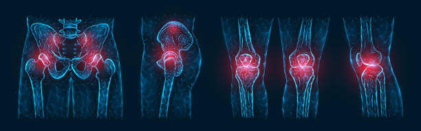 полигональный вектор иллюстрации боли или воспаления костей в тазе, тазобедренном суставе и коленных суставах изолированы на темно-синий � - ischium stock illustrations