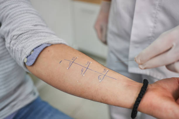 Doctor performing alergy test on a patient’s arm Doctor doing an allergy test on a patient arm at his modern medical ordination allergy test stock pictures, royalty-free photos & images