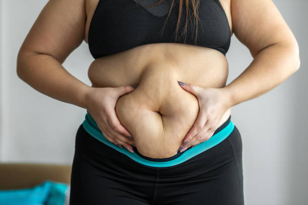istock Overweight woman 1300195517