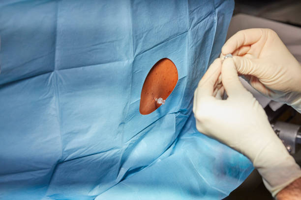 Doctor is performing an Epidural before surgery