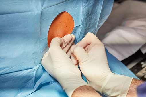 Doctor performing an Epidural anaesthetic before a knee surgery