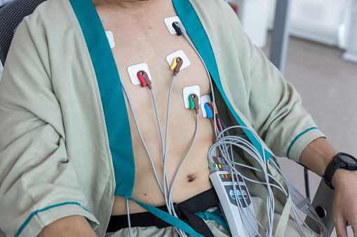 Electrocardiograma cardíaco o monitorización usando Holter para pacientes jóvenes. El atleta masculino hace una prueba de estrés cardíaco. dispositivo de monitor Holter para la monitorización diaria de un electrocardiograma. photo