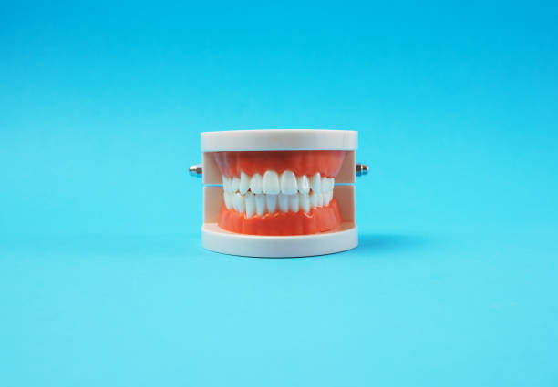 istock plastic model of a human jaw with white teeth on a blue background 1300498629