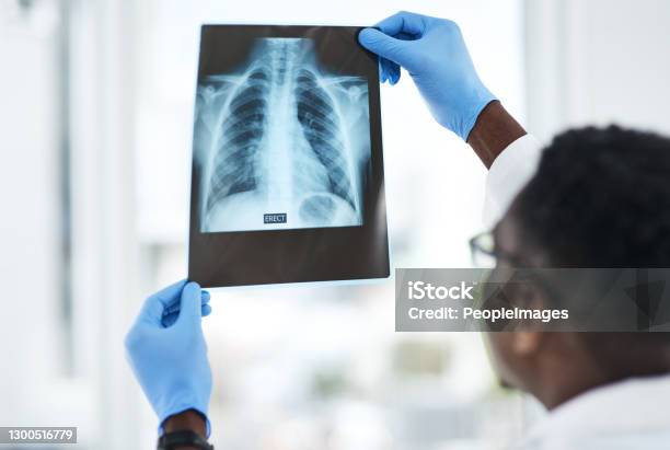 The Answer Is Hidden Between The Lines Stock Photo - Download Image Now - X-ray Image, Lung, Doctor