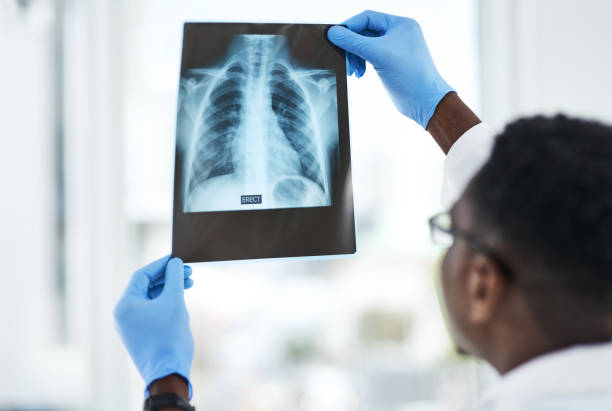 odpowiedź jest ukryta między wierszami - x ray x ray image chest human lung zdjęcia i obrazy z banku zdjęć