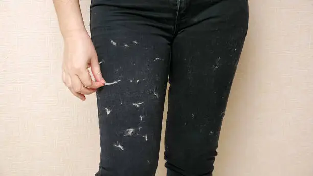 Photo of Woman tries to clean black pants covered with animal hair