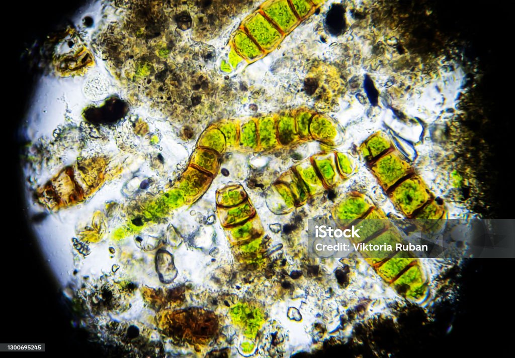 Microalgae under a microscope, sample taken from moss Phytoplankton Stock Photo