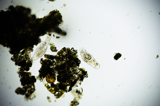 Microscopic Rotifer or Rotifera under a microscope, freshwater bentic organism filtering water.