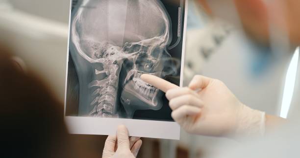 istock Dentist showing x-ray of a skull for a young patient 1300865232
