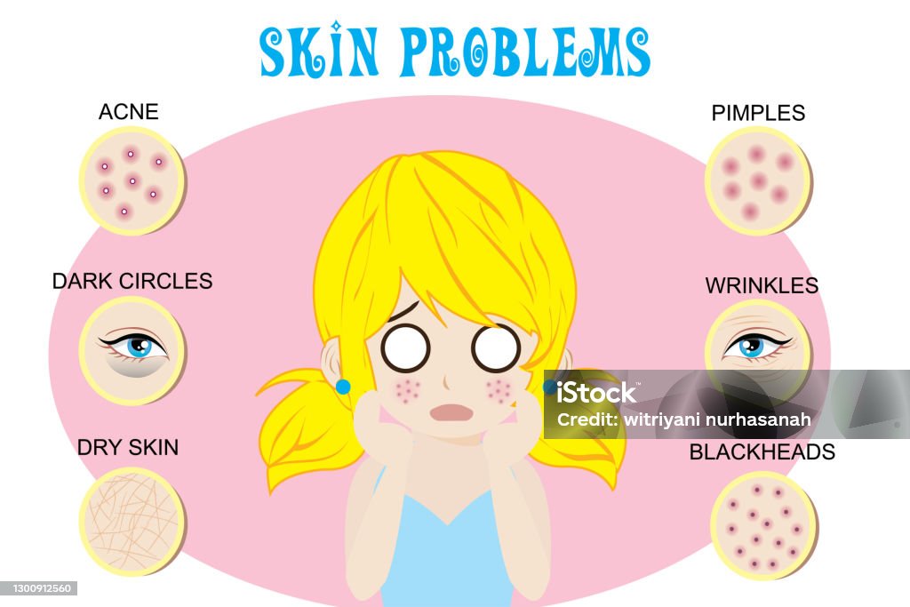 Face Problem Sign 6 Common Skin Problems On Face Stock Illustration - Download Image Now ...