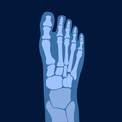 Normal Bone Profile Example Normal Bones Stock Illustration - Download Image Now - Anatomy, Ankle ...