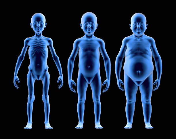 undernourished child, with normal build and obese child in comparison - undernourishment imagens e fotografias de stock