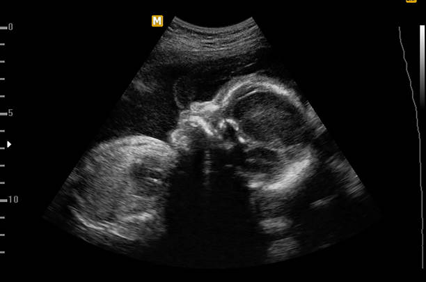 ultrasonido del bebé en mujer embarazada, doctor leyendo los resultados de las pruebas de lectura de la mujer embarazada por ultrasonido. - ultrasound human pregnancy ultrasound machine doctor fotografías e imágenes de stock