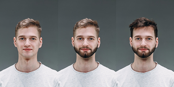 Blonde. Collage of man before and after visiting barbershop, client's delighted with different haircut, mustache, beard. concept of bodycare, male beauty, comparison. Shaving, hairstyling, coloring.