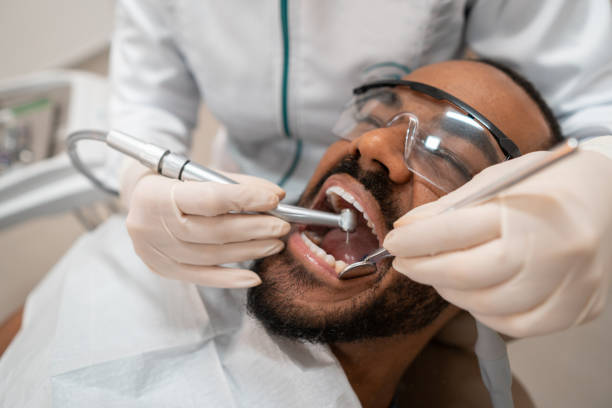 dentista che utilizza trapano dentale sul paziente - dental drill foto e immagini stock