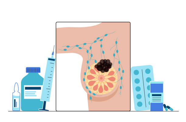 ilustrações de stock, clip art, desenhos animados e ícones de breast disease concept - cancer cell cancer breast cancer breast