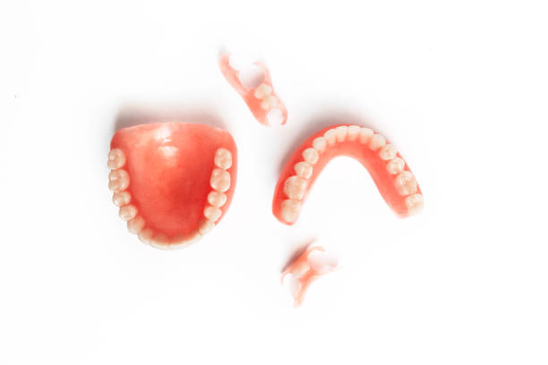 Dentures on a white background. Close-up of dentures. Full removable plastic denture of the jaws. Prosthetic dentistry. False teeth. Close-up of plastic dentures. Teeth on a white background dentaduras sobre un fondo blanco. primer plano de las dentaduras postizas. dentadura de plástico desmontable completa de las mandíbulas. odontología protésica. dientes falsos. primer plano de dentaduras postizas de plástico. dientes sobre un fondo bla