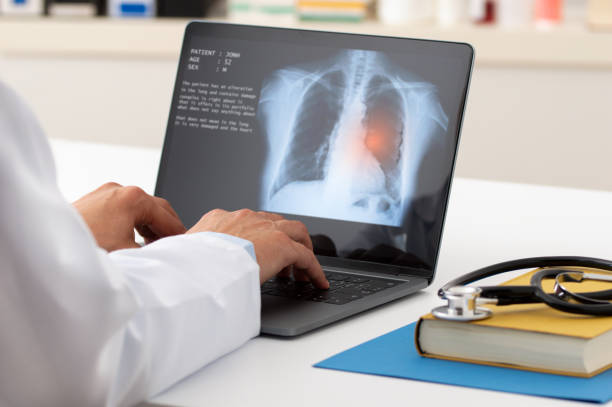 A pulmonologist working with laptop A pulmonologist working with laptop at office. Health care concept. respiratory disease stock pictures, royalty-free photos & images
