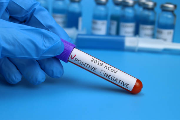 istock Doctor, nurse keep positive blood test for coronavirus 1301640006