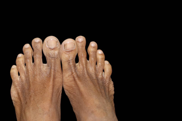 Human Male Feet In Isolated Black Background