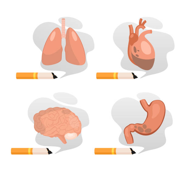 Harm of smoking to lungs stomach brain heart set, stop smoking isolated on white Harm of smoking to lungs stomach brain heart vector illustration set. Cartoon nicotine addiction harmful to respiratory cardiovascular gastrointestinal nervous system, stop smoking isolated on white anti tobacco day stock illustrations