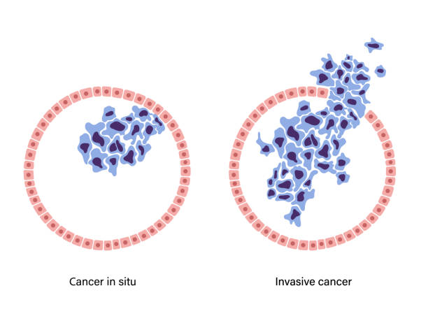 ilustrações de stock, clip art, desenhos animados e ícones de breast disease concept - adipose cell