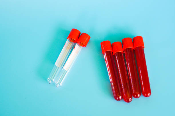 istock test tube with blood sample 1301890582