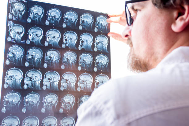 läkare utvärdering resultat av magnetisk resonans imaging av hjärnan i sjukhus koncept foto. neurolog i glasögon håller handen på glas av negatoscope mri-skanning och undersöker strukturen hos hjärnvävnad - brain scan' bildbanksfoton och bilder