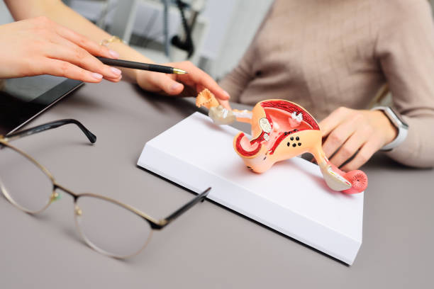 model of a human uterus in the hands of a gynecologist close-up. model of a human uterus in the hands of a gynecologist close-up. Women's consultation fallopian tube stock pictures, royalty-free photos & images