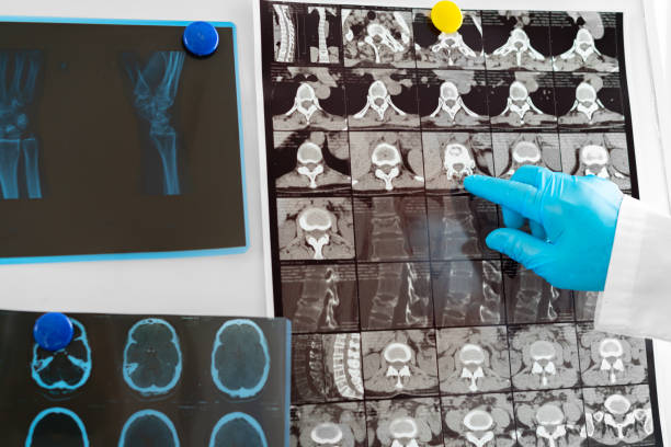 istock Hands of a doctor holding head mri scan 1302225093