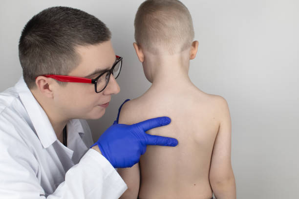 a little boy at the doctor's appointment with back pain. treatment of spinal deformity and stoop. osteoporosis, kyphosis, lordosis, or scoliosis. - front stoop imagens e fotografias de stock