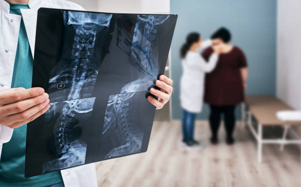 의사는 배경 골관절염 검진- 과체중 여성의 척추 위에 자궁 경부 척추의 엑스레이를 보유하고 있습니다. 척추의 척추측만증, 진단 - human spine mri scan x ray doctor 뉴스 사진 이미지
